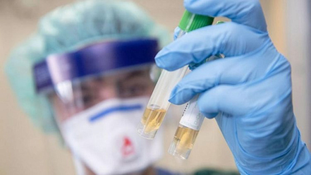 There are not enough specialists in the State Sanitary and Epidemiological Supervision laboratory. The departments of KSMA and KRSU were connected