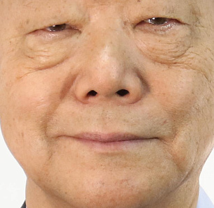 placeholder-image